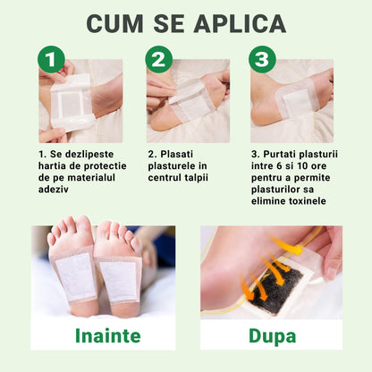 Set de 30 Plasturi pentru Talpi